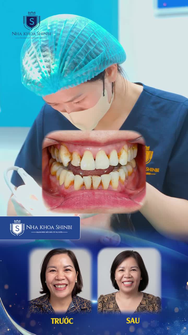 Nụ cười mới, hạnh phúc rạng ngời ở tuổi 56