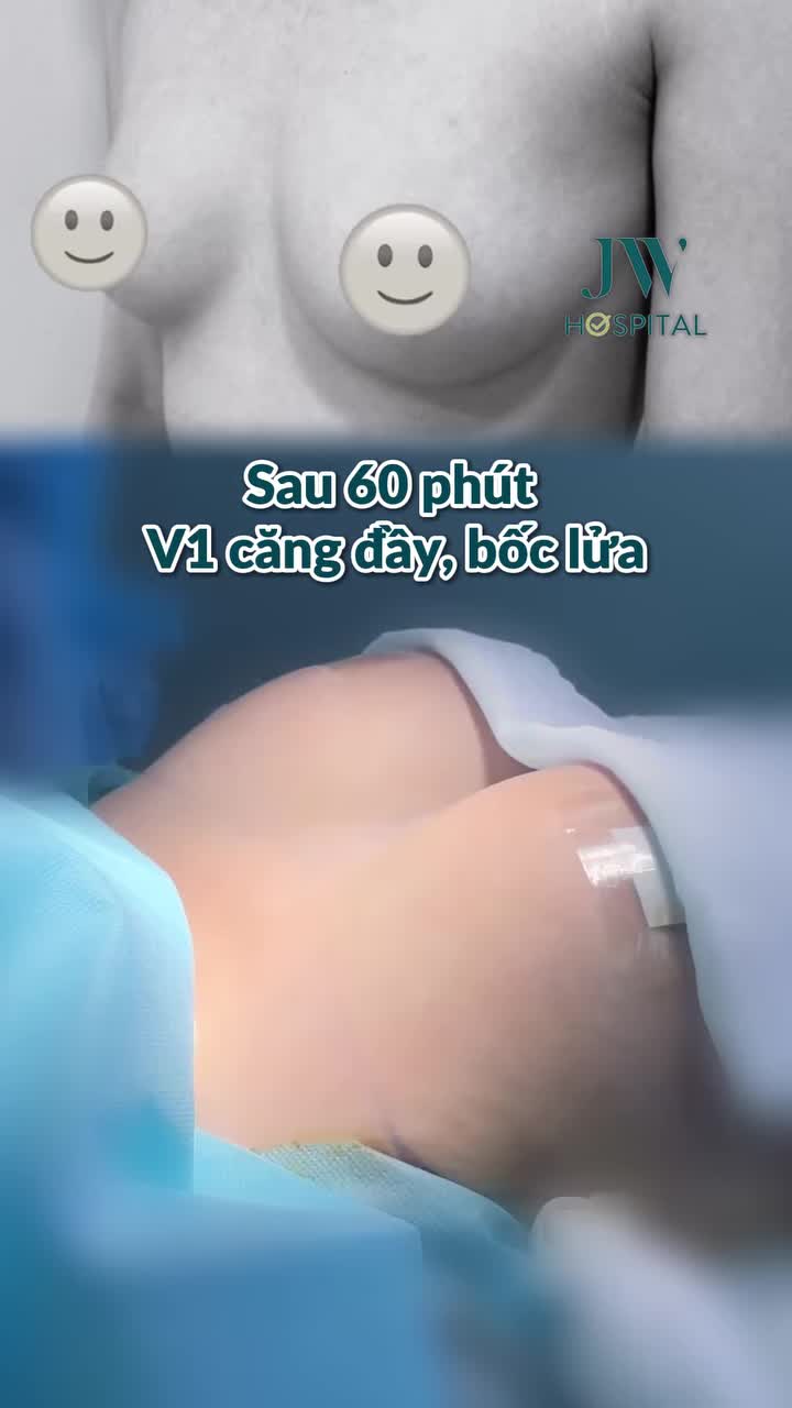 ĐỘ LOA ERGONOMIX 2, XOÁ TEO LÉP - KIẾN TẠO VÒNG 1 CĂNG ĐẦY, ĐẸP QUYẾN RŨ CHO PHỤ NỮ HIỆN ĐẠI