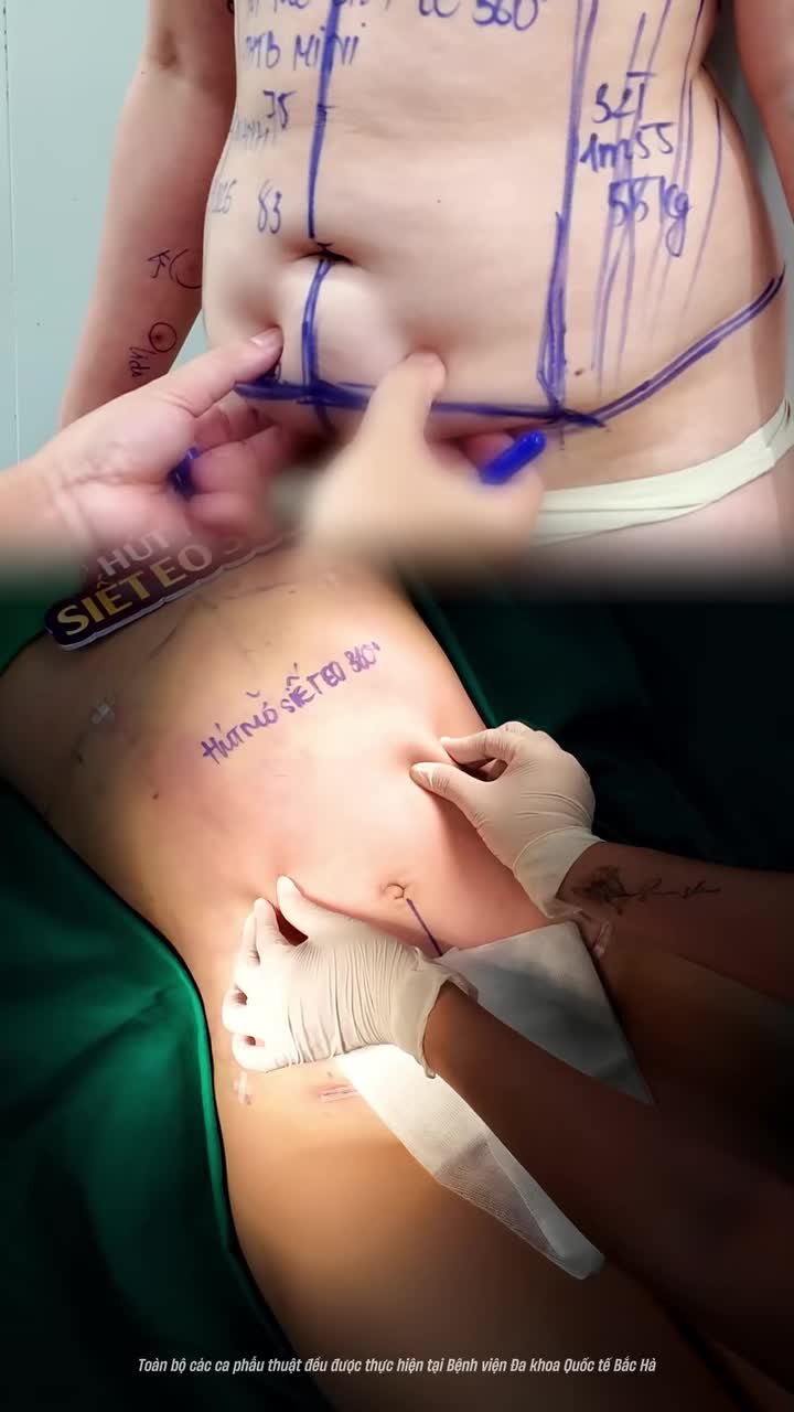 ĐỘ BODY CÓ THỰC SỰ ĐAU NHƯ LỜI ĐỒN?