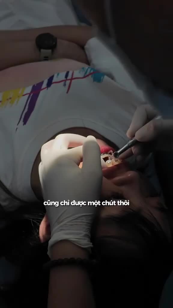 Cắt kẽ răng khi niềng răng có đau không?