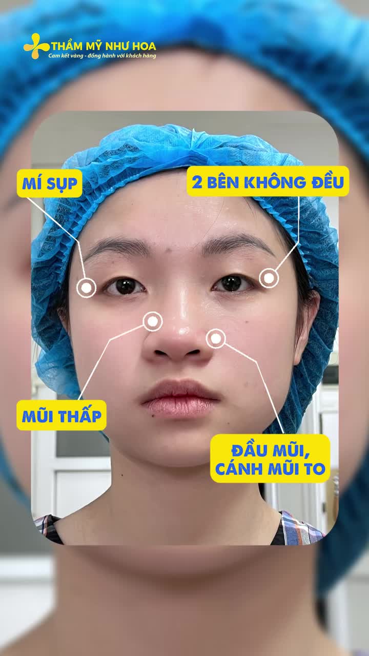 F5 diện mạo cùng chị đẹp Thảo My với nâng mũi và tạo hình mí với Tiến sĩ Tống Hải tại Thẩm mỹ Như Hoa