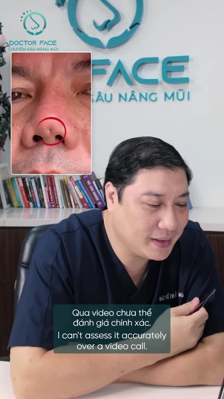 Một điểm lõm ở đầu mũi, nhưng điều bác sĩ quan tâm lại nằm ở phần mô bên dưới.