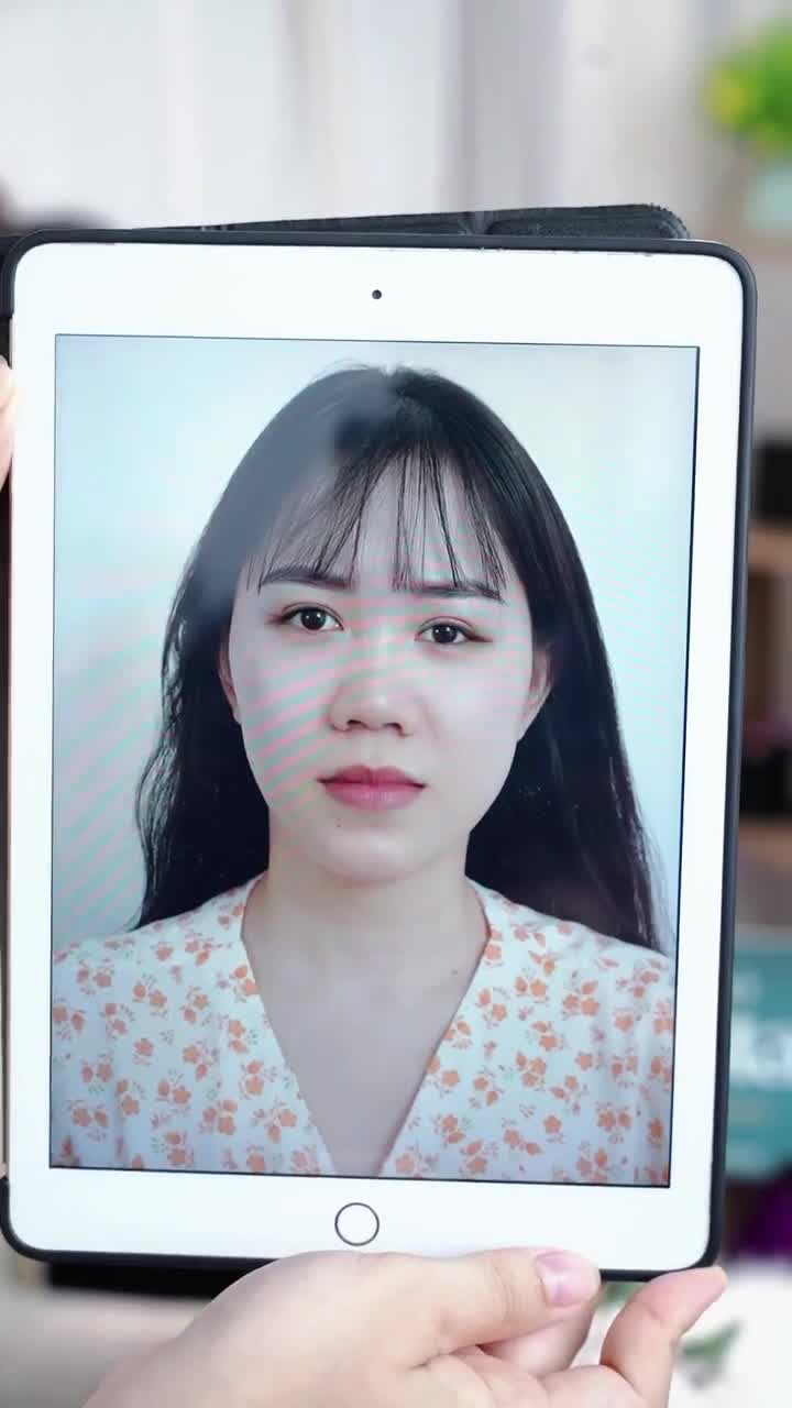CẢI THIỆN KHUYẾT ĐIỂM MŨI SAU 10 NGÀY NÂNG MŨI CẤU TRÚC