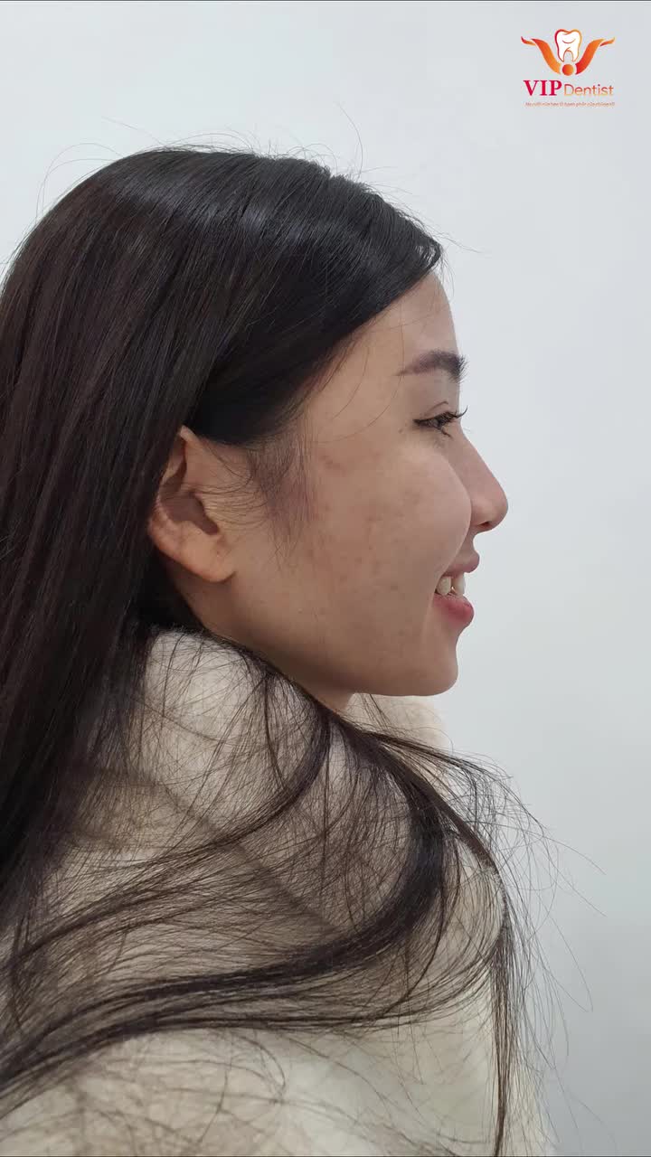 HỐI HẬN NẾU KHÔNG NIỀNG SỚM HƠN