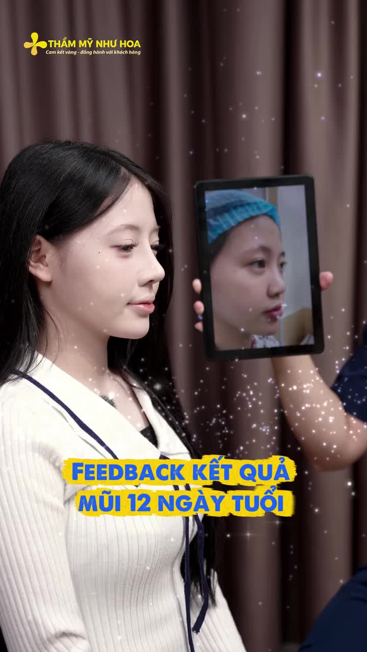 "Làm xong nhẹ lắm, chả có gì" - chia sẻ của chị đẹp Khánh Hòa sau 12 ngày nâng mũi và nâng cấp vòng 1 tại Viện Bỏng Quốc Gia cùng Thạc sĩ Lê Hùng