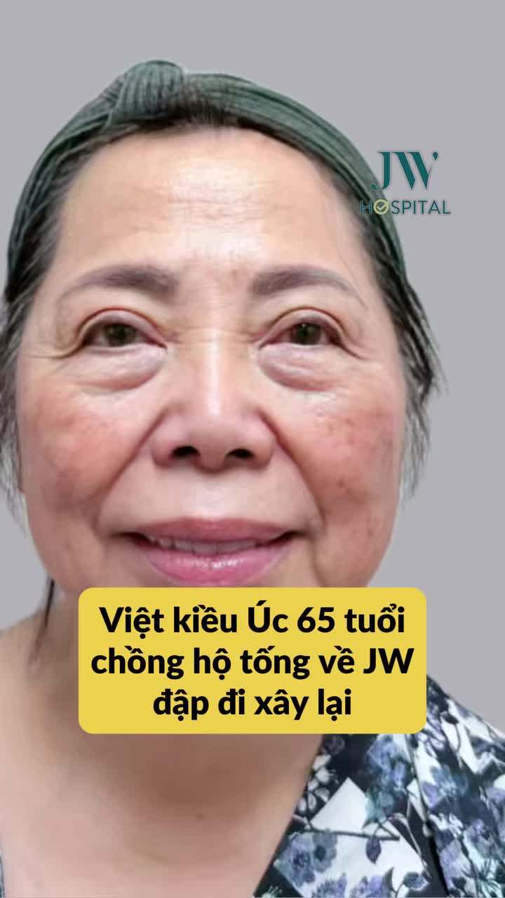 BỎ QUA THẨM MỸ Ở ÚC: QUÝ BÀ U70 ĐƯỢC CHỒNG HỘ TỐNG VỀ NƯỚC ĐẬP ĐI XÂY LẠI, TRẺ 20 TUỔI TẠI JW
