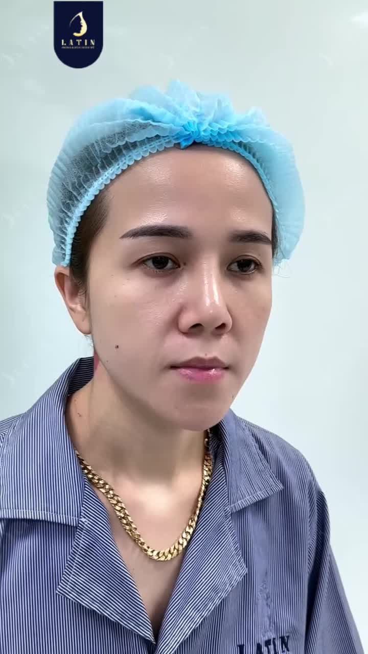 CỨU CÁNH DÁNG MÍ CHƯA ƯNG Ý: RẠNG RỠ CHỈ SAU 7 NGÀY