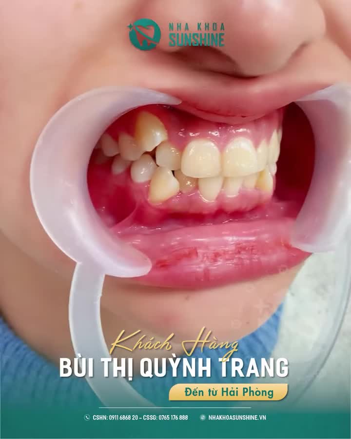 HẢI PHÒNG LÊN HÀ NỘI — ĐỔI Ố VÀNG, KHẤP KHỂNH LẤY NỤ CƯỜI VẠN NGƯỜI MÊ!