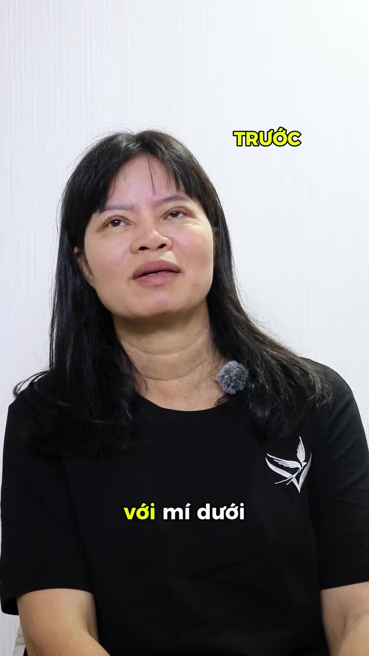 KHÁCH HÀNG CHẤM 10 ĐIỂM CHO DỊCH VỤ TẠO HÌNH MÍ TẠI DR. TRÍ