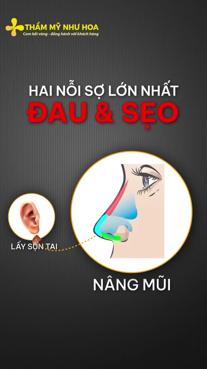 Lấy sụn tai khi nâng mũi có thật sự đáng lo như các chị đẹp nghĩ?