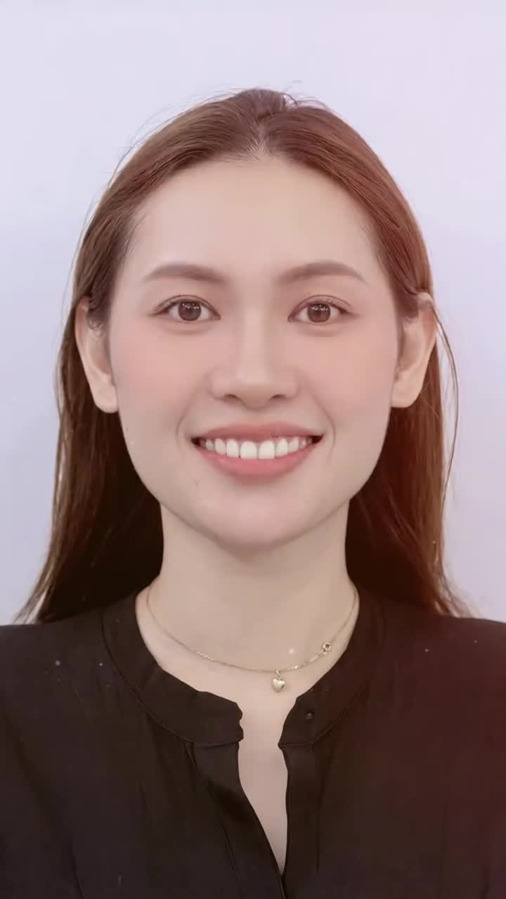 Bác sĩ Đăng Lưu chỉ "hô biến" một tí trên răng nhưng lại giúp nâng cấp cho nụ cười Niềng-er thêm rạng rỡ nhiều phần...