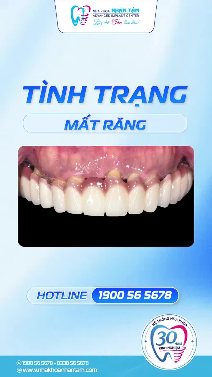 KHÔI PHỤC HÀM RĂNG CHẮC KHỎE – ĂN NHAI THOẢI MÁI