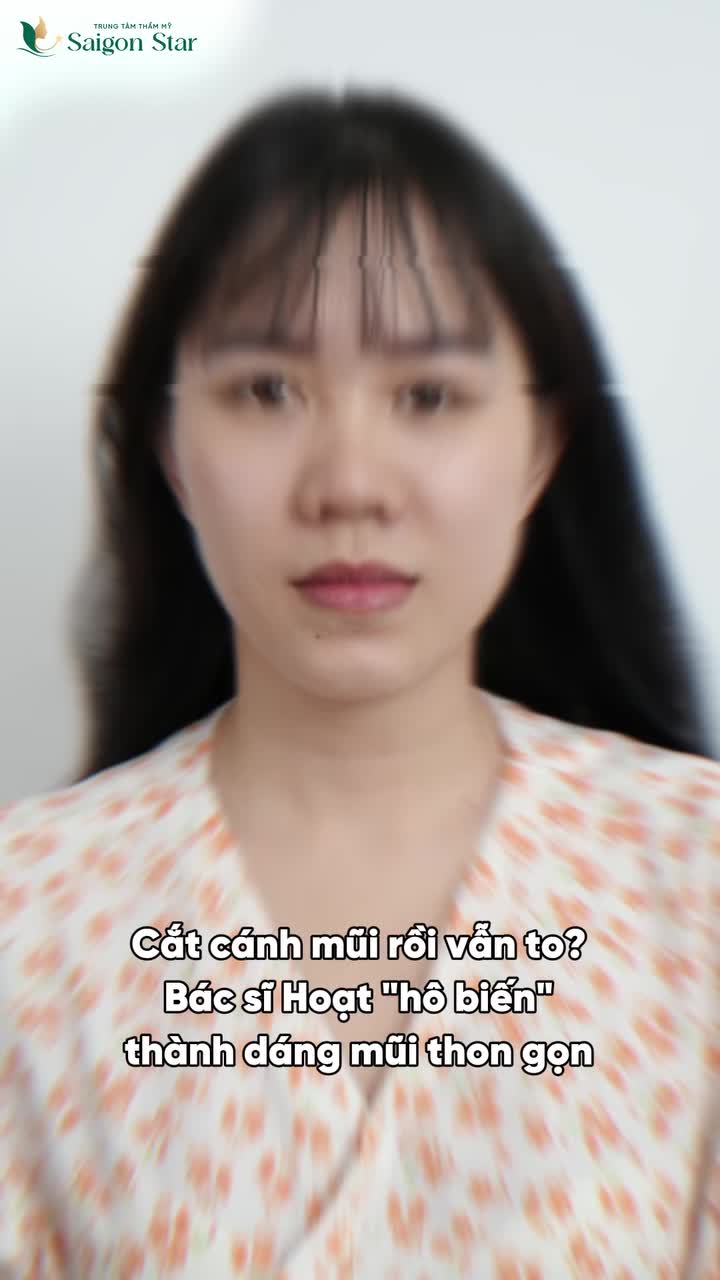 HÔ BIẾN CÁNH MŨI TO THÔ TRỞ NÊN THON GỌN VỚI TIÊU CHÍ 3 KHÔNG: KHÔNG ĐAU - KHÔNG SẸO - KHÔNG NGHỈ DƯỠNG