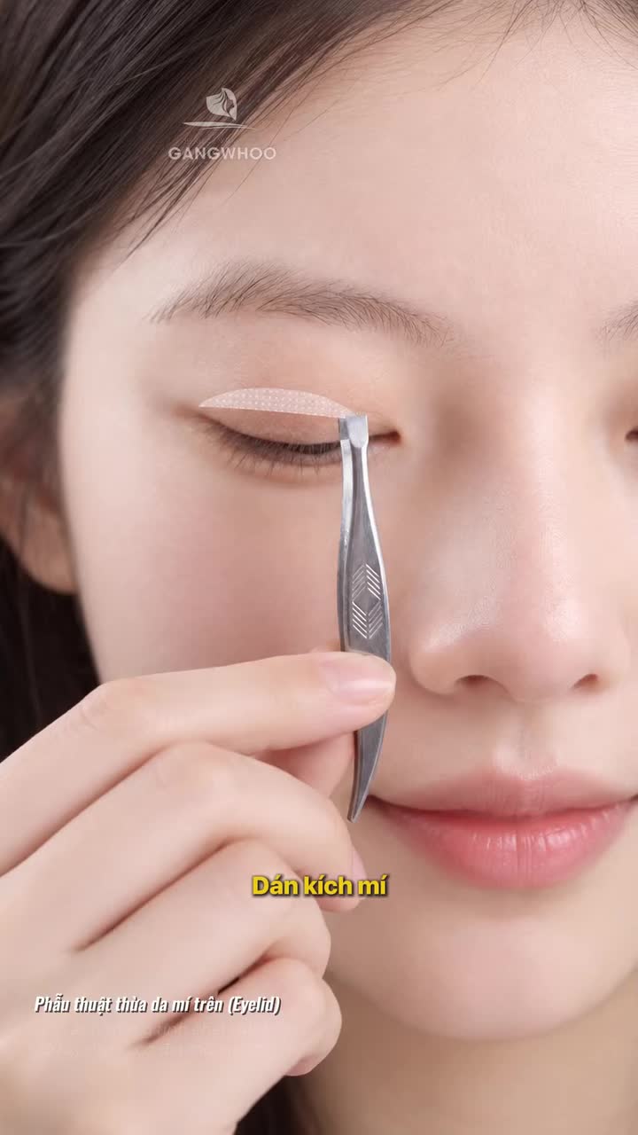 Dán kích mí có giúp mắt to và đẹp hơn không?