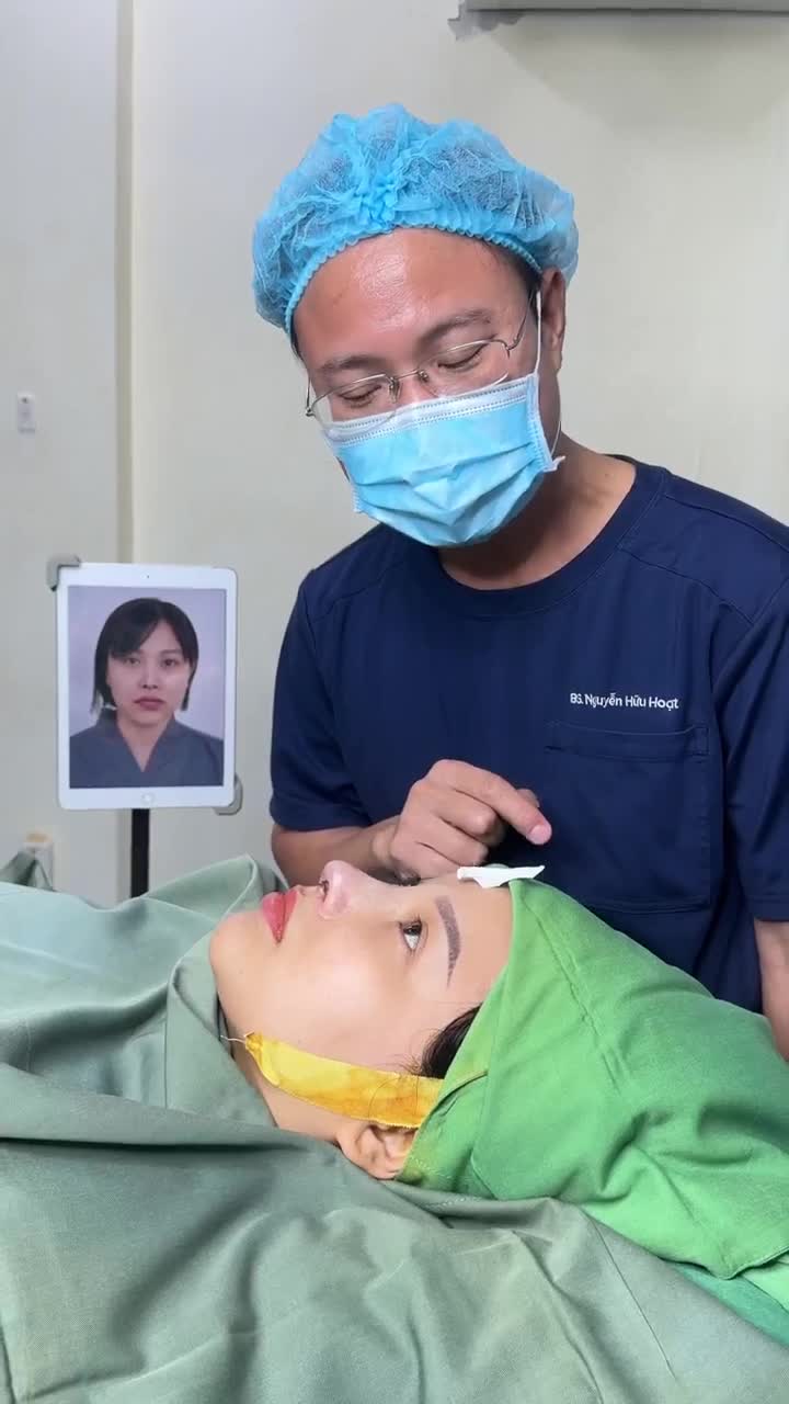 BÁC SĨ HOẠT TRẢ KẾT QUẢ SAU 60 PHÚT SỬA LẠI MŨI HỎNG