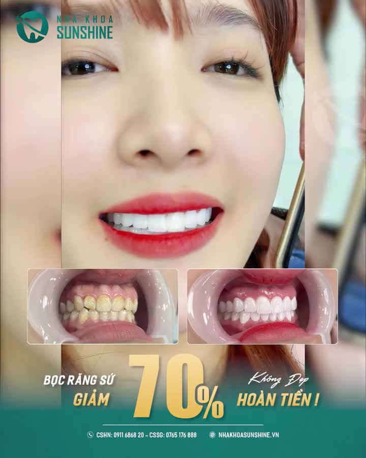 SỐC: GIẢM 70% BỌC RĂNG SỨ — HOÀN TIỀN NẾU KHÔNG HÀI LÒNG!
