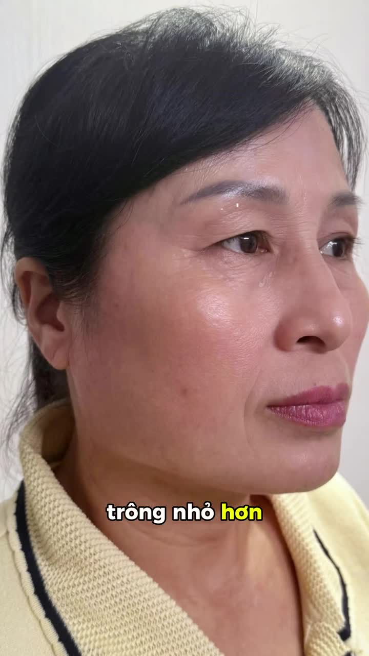 GIẢI CỨU ĐÔI MẮT LÃO HÓA CÙNG COMBO ĐỈNH CAO TỪ DR. TRÍ