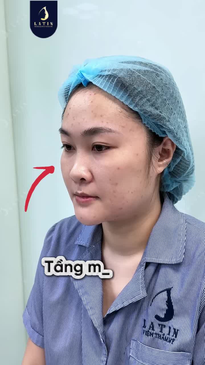 TỪ GƯƠNG MẶT THIẾU ĐIỂM NHẤN ĐẾN ĐƯỜNG NÉT CAO SANG