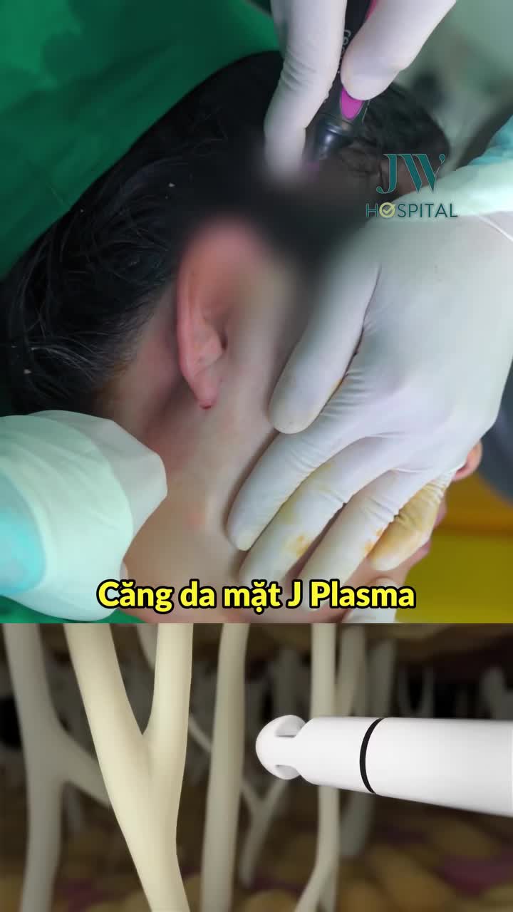 ĐIỂM DANH 2 PHƯƠNG PHÁP CĂNG DA MẶT HOT ΝΗẤT TẠI JW DÀNH CHO CHỊ EM U50–U80
