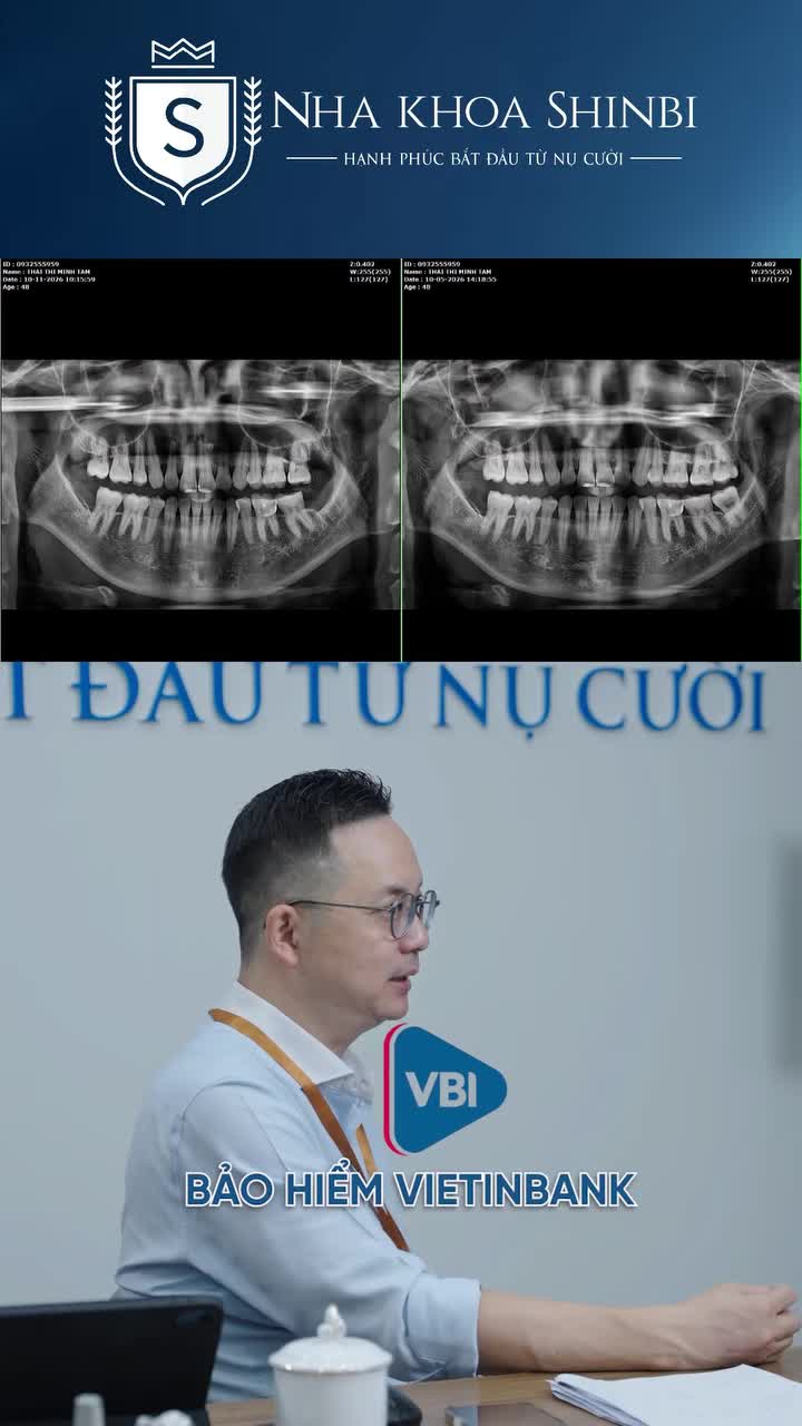 BẢO HIỂM VIETINBANK (VBI) "ĐẶC QUYỀN" ĐẾN ĐÂU KHI NHỔ RĂNG?