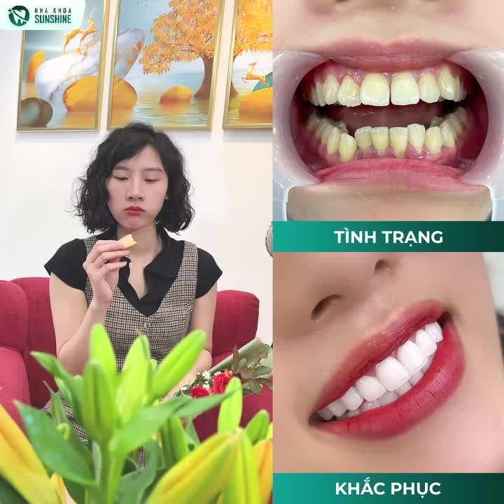 "BỌC RĂNG SỨ CHUẨN Y KHOA: ĂN NGAY TỰ NHIÊN – BỀN CHẮC TRỌN ĐỜI!"