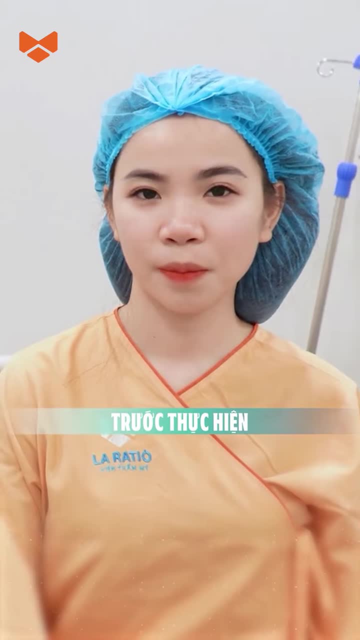 Mời mọi người chấm điểm cho dáng mũi này nào