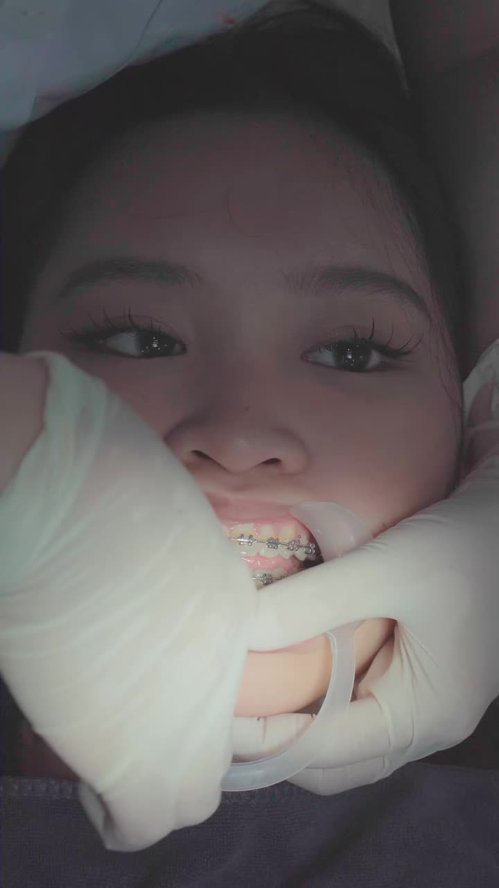 THÁO MẮC CÀI - KHOẢNH KHẮC MÀ AI NIỀNG RĂNG CŨNG MONG CHỜ!