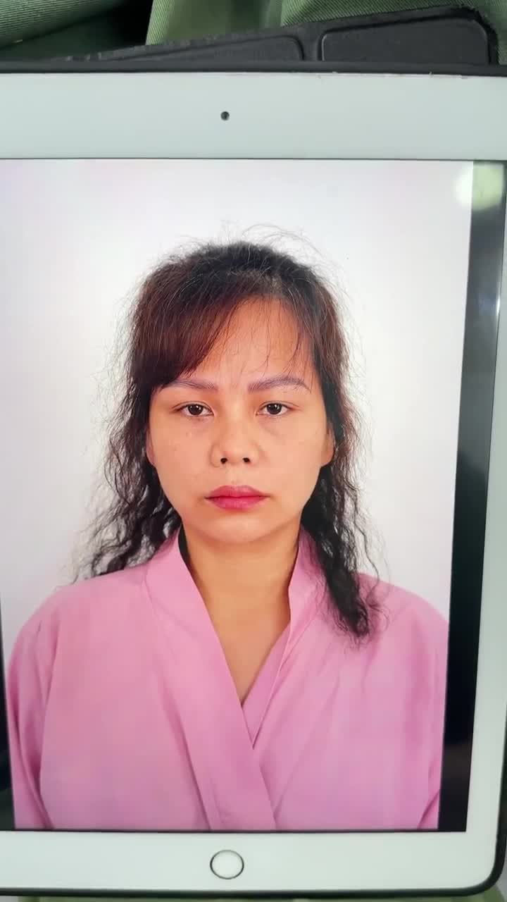 TRẢ KẾT QUẢ NÂNG MŨI CẤU TRÚC SỬA LẠI KH. JESSICA HỒ (MỸ)