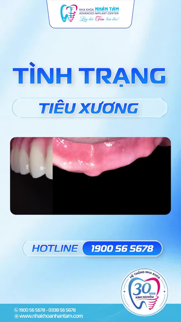 TRỒNG IMPLANT, PHÉP MÀU CHO NGƯỜI MẤT RĂNG