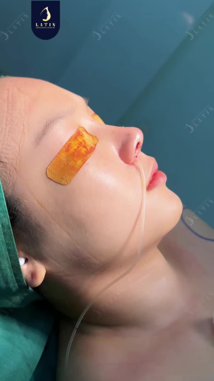 UNBOXING DÁNG MŨI CẤU TRÚC SAU 45 PHÚT TẠI LATIN
