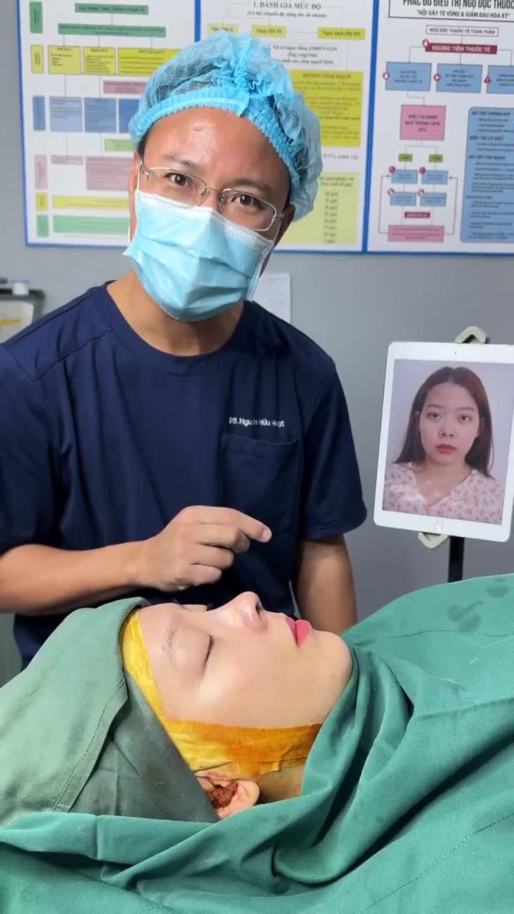 BÁC SĨ HOẠT TRẢ KẾT QUẢ NÂNG MŨI CẤU TRÚC