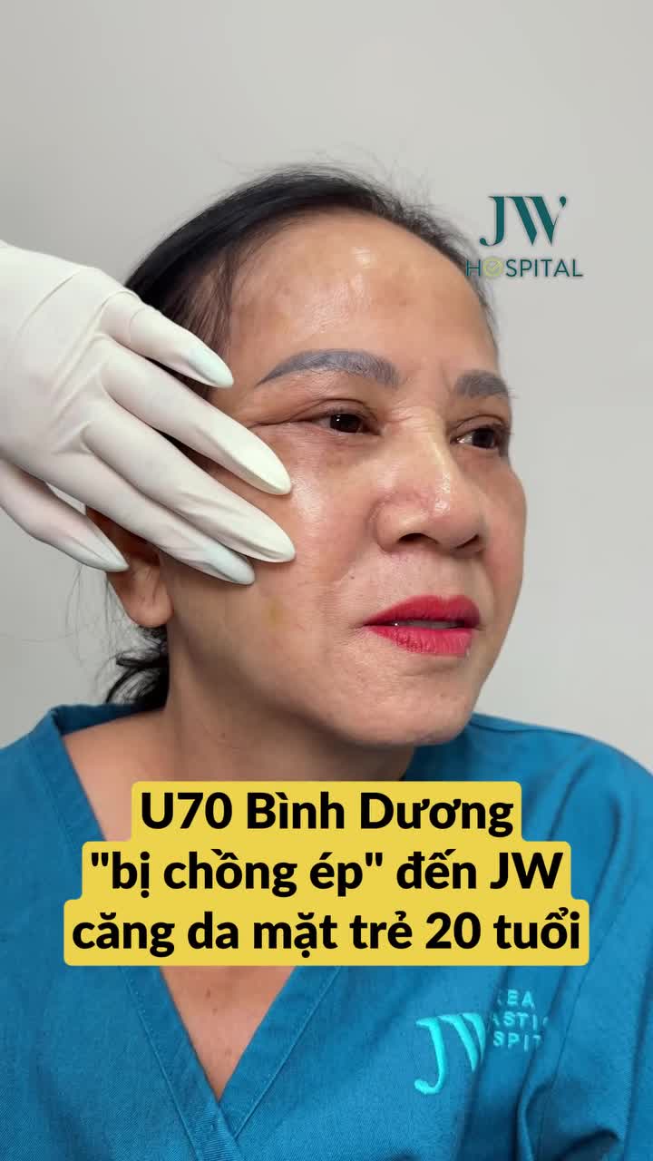 QUÝ CÔ U70 BÌNH DƯƠNG ĐƯỢC CHỒNG CHO 100 TRIỆU ĐỂ TÌM BÁC SĨ TÚ DUNG CĂNG DA MẶT SMAS PRO TRẺ HÓA 20 TUỔI