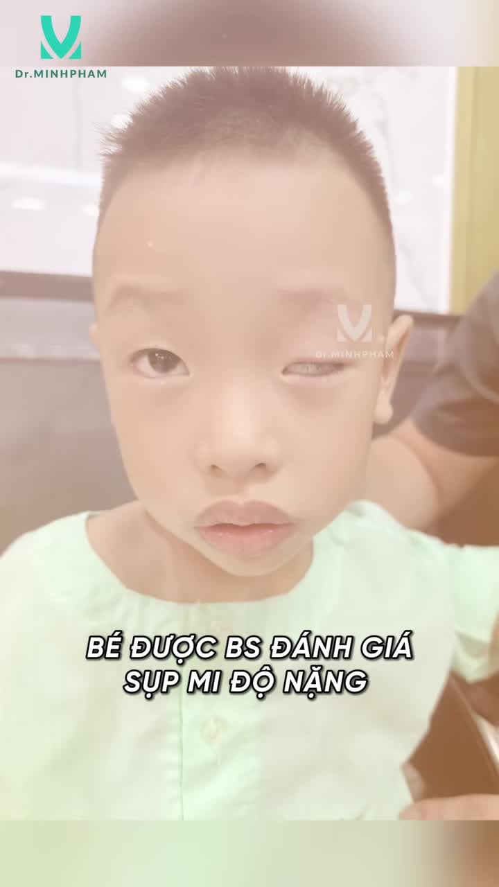 HÀNH TRÌNH HỒI PHỤC SAU TREO MI VCT