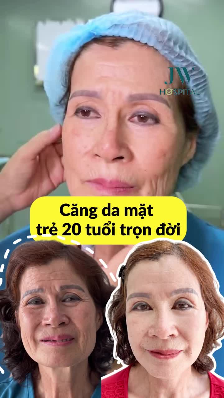 BÁC SĨ TÚ DUNG CĂNG DA CẢI LÃO 20 TUỔI CHO QUÝ CÔ U70 - SẸO TÀNG HÌNH SIÊU MẢNH