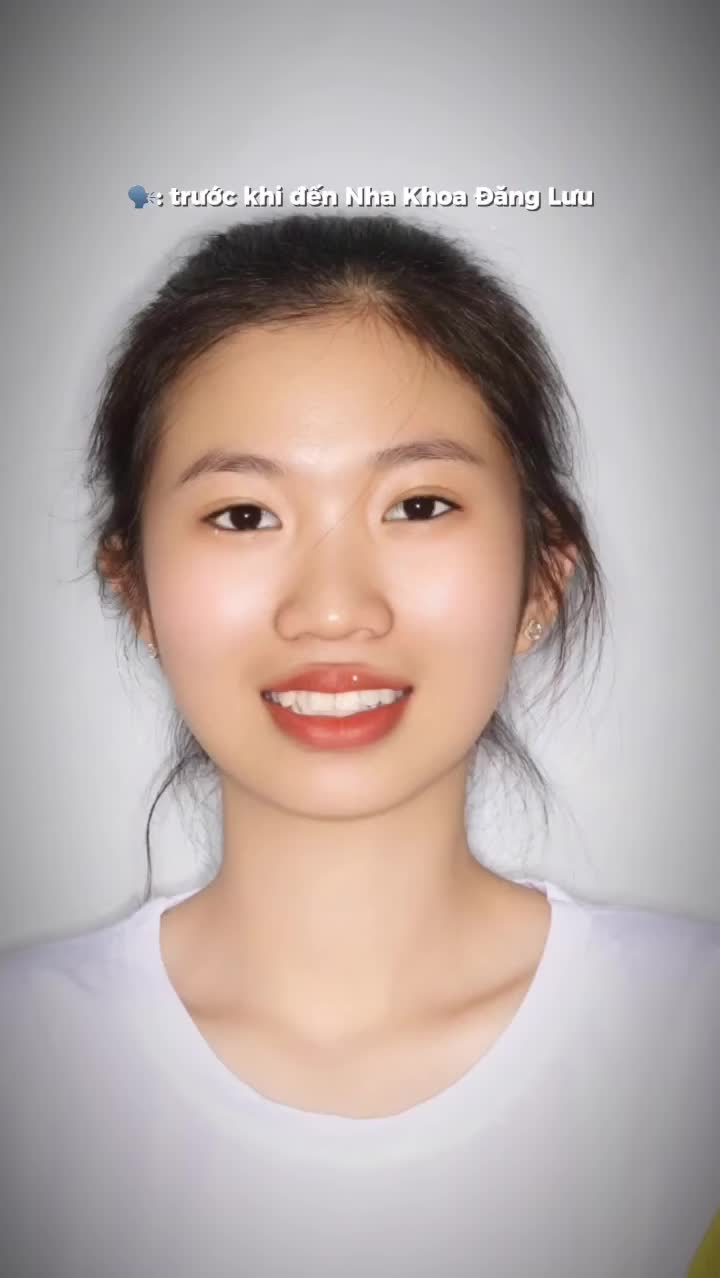 Bắt đầu hành trình nụ cười của Bạn ngay hôm nay cùng bác sĩ Nha Khoa Đăng Lưu - thấu hiểu mong muốn và tìm ra phác đồ niềng răng phù hợp dành cho riêng Bạn