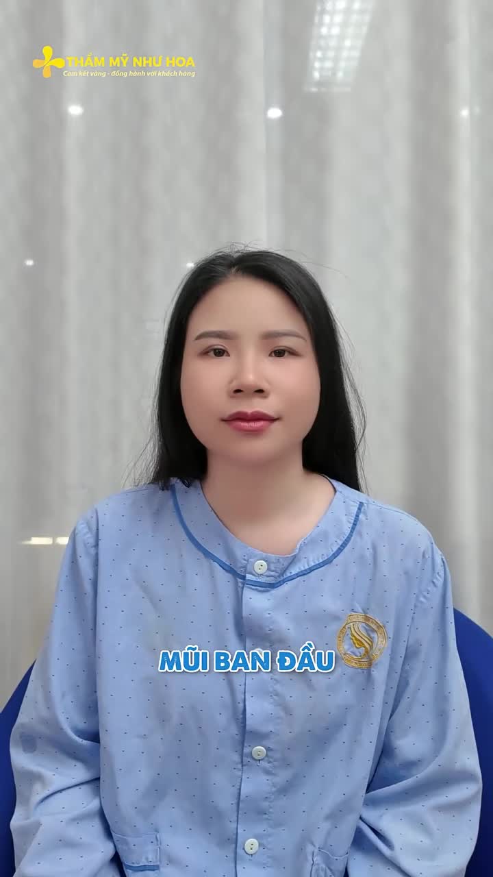 Kết quả sau nâng mũi của chị đẹp Nguyễn Quỳnh sau khi được ekip Thẩm mỹ Như Hoa thực hiên