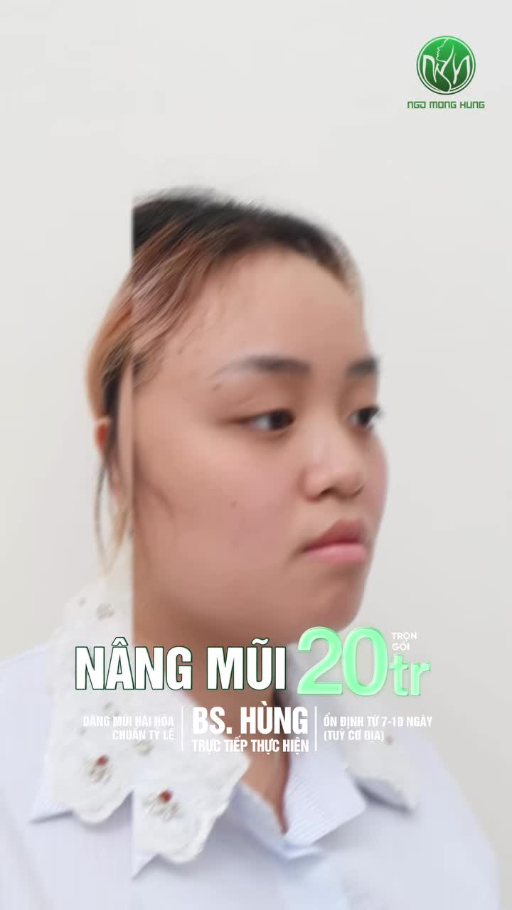 Dậy thì thành công sau khi đến Bệnh Viện Thẩm Mỹ Ngô Mộng Hùng