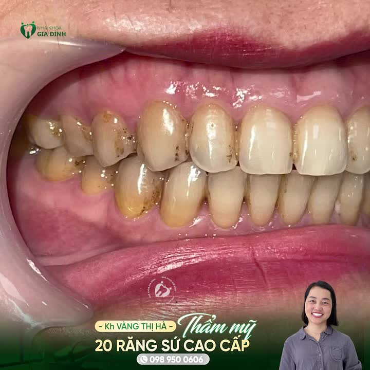 TỪ HÀ GIANG ĐẾN HÀ NỘI - ĐỔI THAY NỤ CƯỜI CỦA CÔ GIÁO VÀNG THỊ HÀ