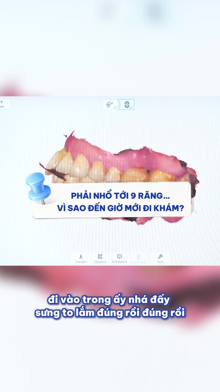 NHỔ 9 RĂNG CÙNG LÚC – VÌ ĐÂU ĐẾN NỖI?