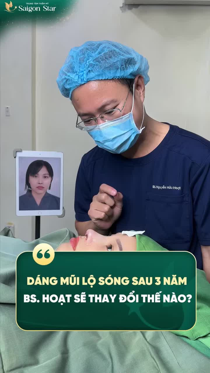 NÂNG MŨI 3 NĂM DẦN BIẾN CHỨNG ĐẾN VỚI BÁC SĨ HOẠT, CHỈ 60 PHÚT KHẮC PHỤC MỌI KHUYẾT ĐIỂM