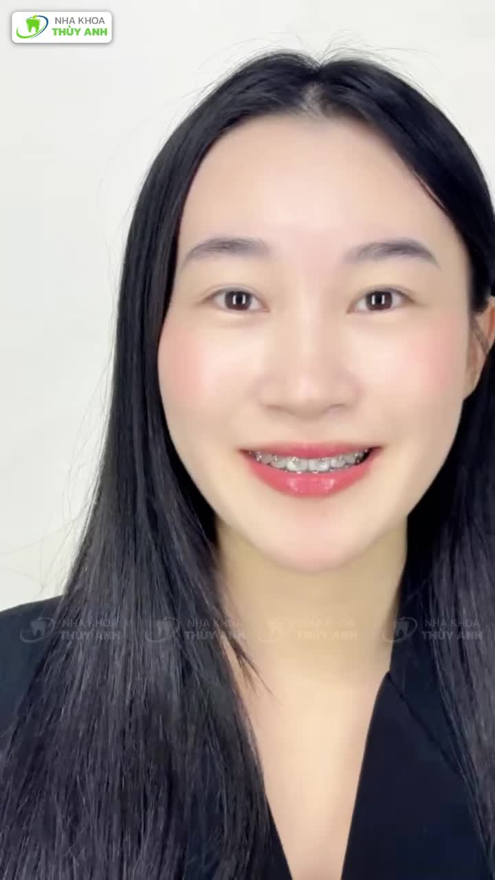 THÁO NIỀNG, THÁO LUÔN TỰ TI