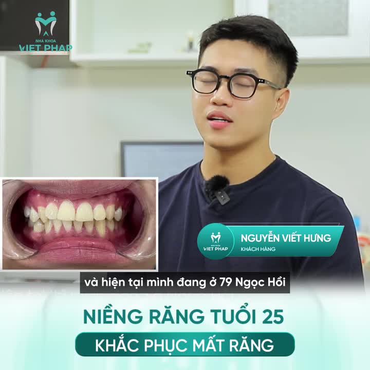 TUỔI 25, HƯNG CHỌN NIỀNG RĂNG ĐỂ LẤY LẠI SỰ TỰ TIN