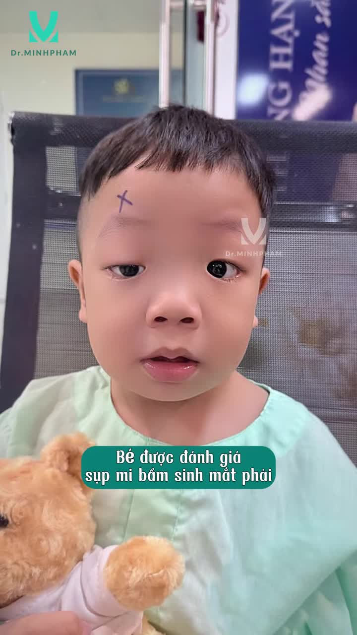 Từ đôi mắt sụp mi khiến ánh nhìn của Gia Hưng có phần hạn chế, em đã trải qua hành trình điều trị tại Dr. Minh Phạm với sự đồng hành của cả ekip.