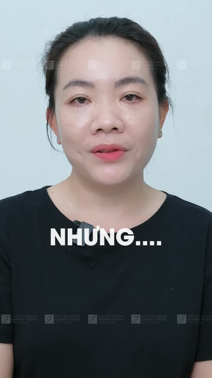 Chỉ mong cải thiện được 7-8 phần ngoại hình vì bọng mắt to và rãnh lệ sâu lâu năm, và kết quả nhận lại khiến khách hàng Như Quỳnh bất ngờ.