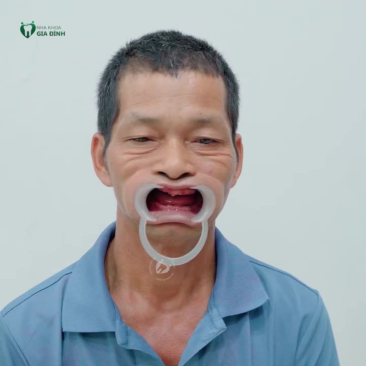 “BIẾT SỚM MÀ LÀM CÁCH ĐÂY 5 NĂM THÌ SỨC KHỎE SẼ TỐT HƠN”