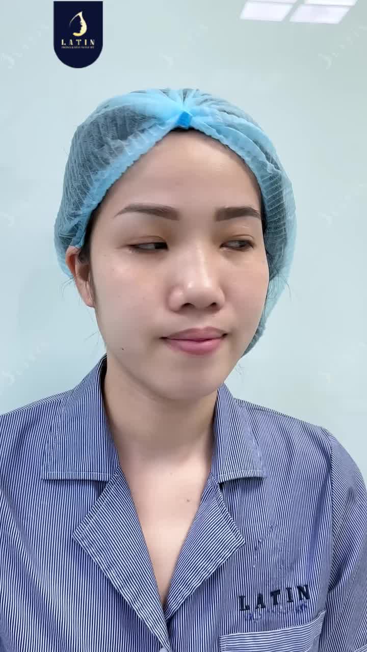 GẶP LẠI CHÍNH MÌNH TRONG PHIÊN BẢN HOÀN HẢO HƠN SAU NÂNG MŨI CẤU TRÚC