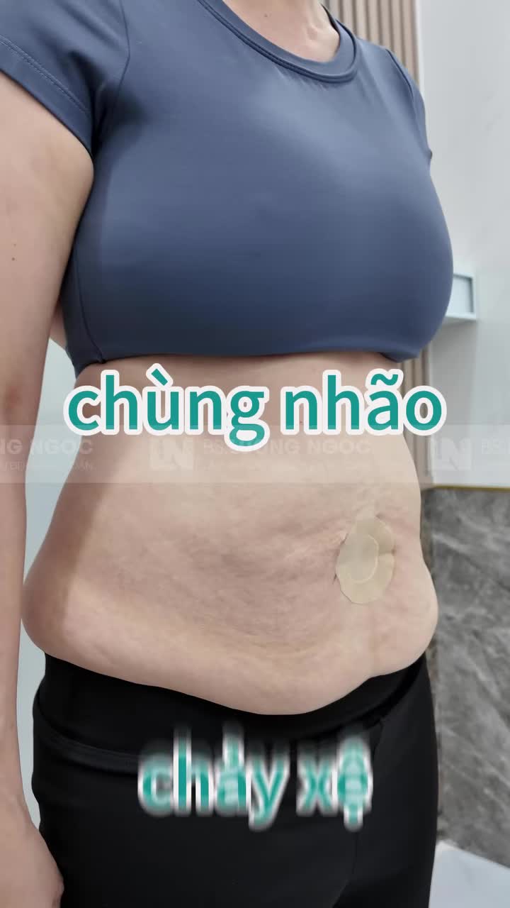 Eo đẹp chỉ sau 1 giấc ngủ trưa. Tưởng chừng là mơ nhưng Bác sĩ Lương Ngọc đã biến điều đó thành sự thật