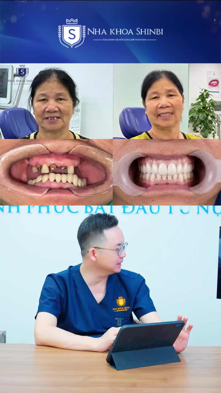 U70 – RĂNG GÃY, RỤNG, CỤT, ĂN NHAI KÉM! LÀM RĂNG Ở TUỔI NÀY LIỆU CÒN HIỆU QUẢ?
