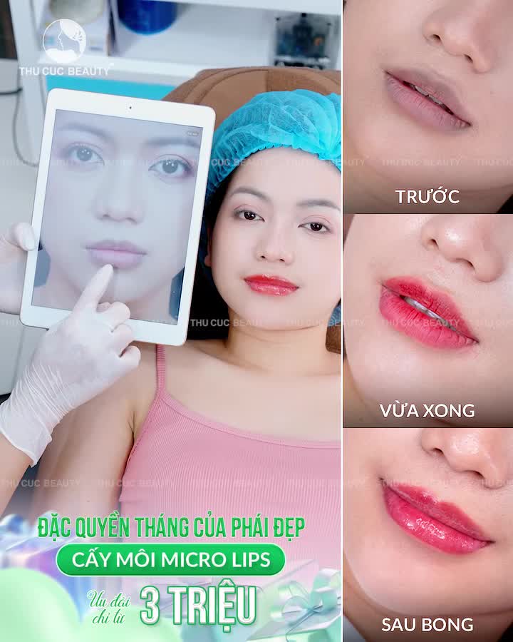 SẮC MÔI TƯƠI TẮN - GƯƠNG MẶT TƯƠI VUI: SIÊU ƯU ĐÃI CẤY MÔI MICRO LIPS CHỈ TỪ 3 TRIỆU!