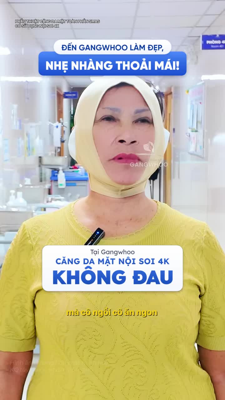 Căng da mặt Smas có sử dụng nội soi 4K nhẹ nhàng - không đau như đi nghỉ dưỡng DMKT: Phẫu thuật căng da mặt toàn phần